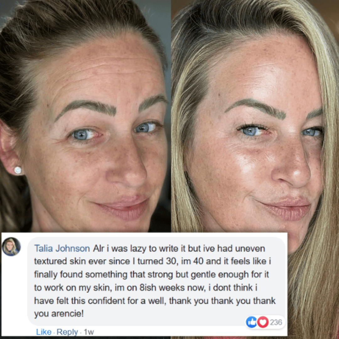 Arencie | Retinal Tightening Booster
