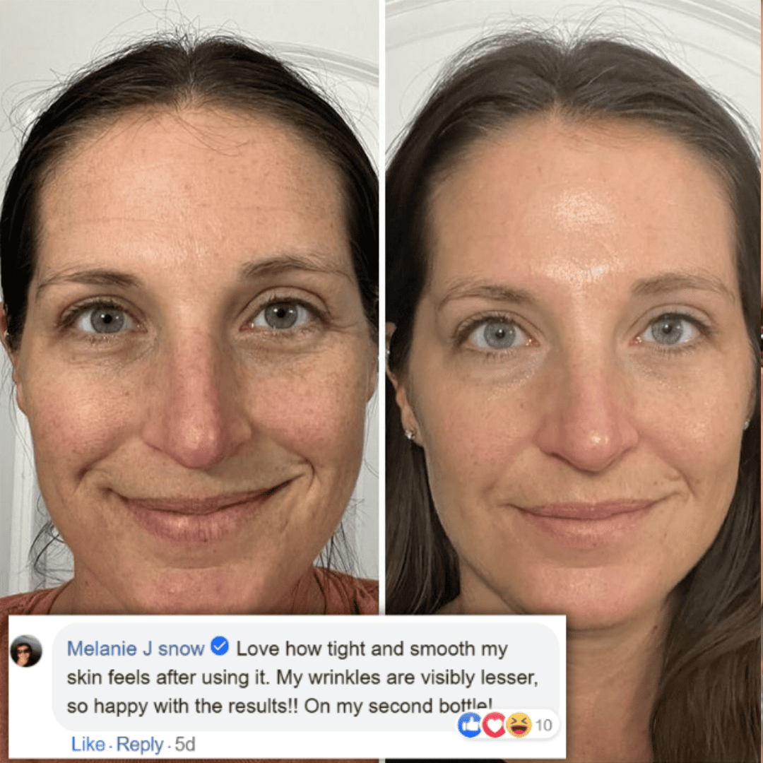Arencie | Retinal Tightening Booster